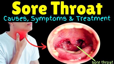 complications of sore throat