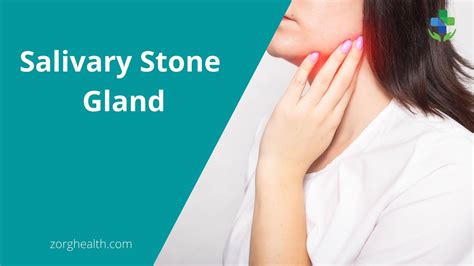 Complications of untreated salivary gland stones