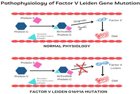 Conclusion and Final Thoughts on Factor 5 Leiden Syndrome
