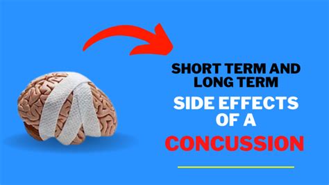 Concussion
