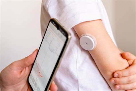 Continuous Glucose Monitoring