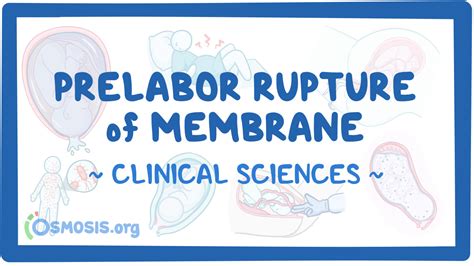 Coping with Prelabor Rupture
