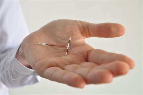 copper iud cost