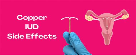 copper iud side effects