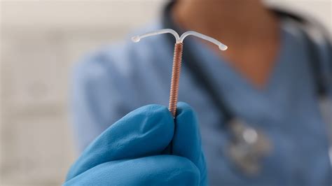 copper iud stis