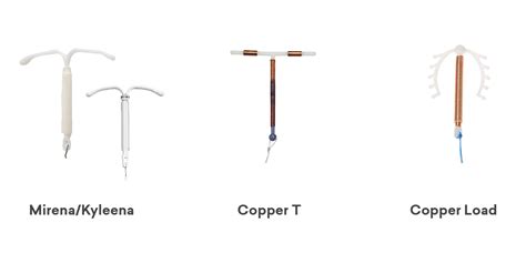 copper iud types
