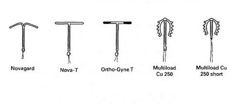 copper iud types
