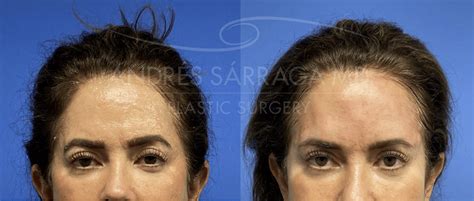 Cosmetic Surgery