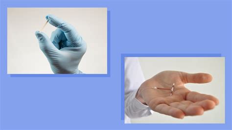 cost and accessibility of arm birth control implant