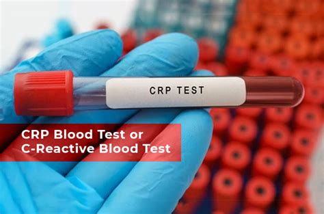 CRP Blood Investigation