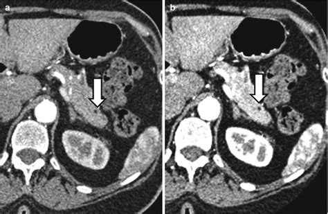 CT Abdomen Applications