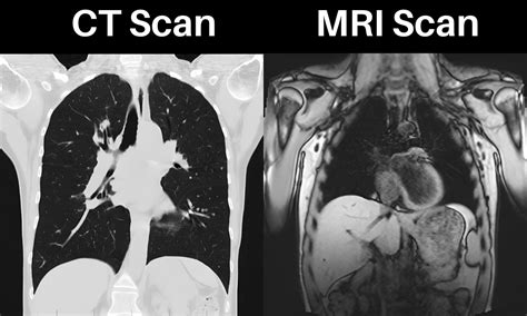CT Scan Machine