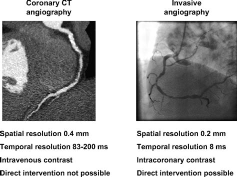 CT Scan Angiogram Applications