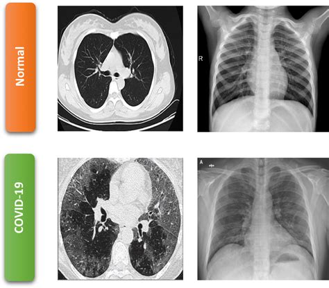 CT Scan Examples