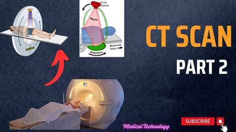 CT scan procedure