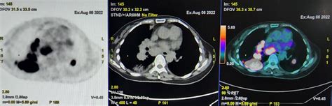 CT Scanner Applications in Medicine