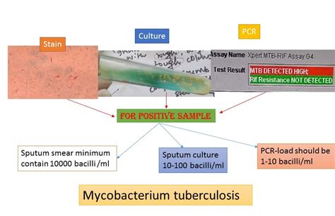 Culture-Based TB Lab Test