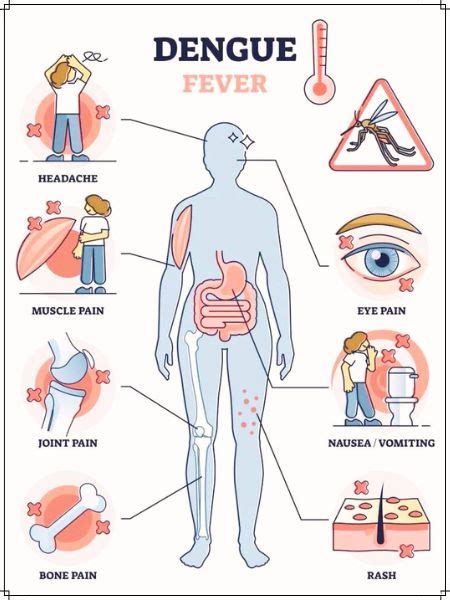 Dengue Fever Complications