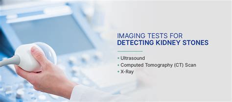 detecting kidney stones