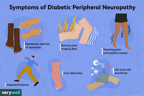 diabetic neuropathy