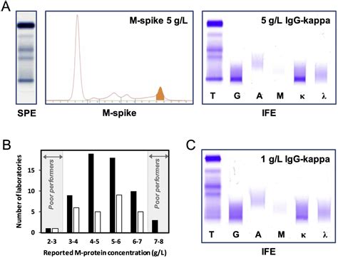 Diagnosing Abnormal Serum Protein Levels