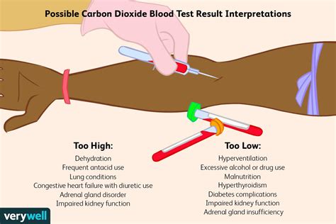 Diagnosing Low Carbon Dioxide Blood Test Results