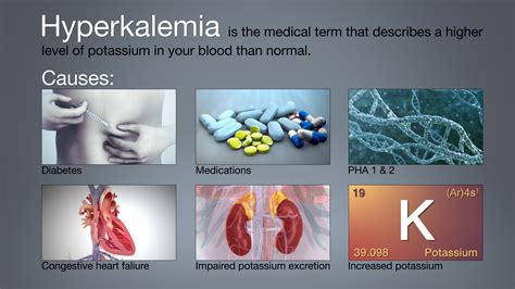 Diagnosing Potassium Overload