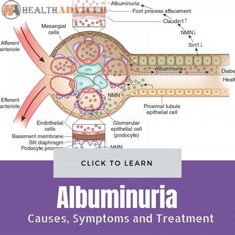 diagnosis and treatment of albuminuria
