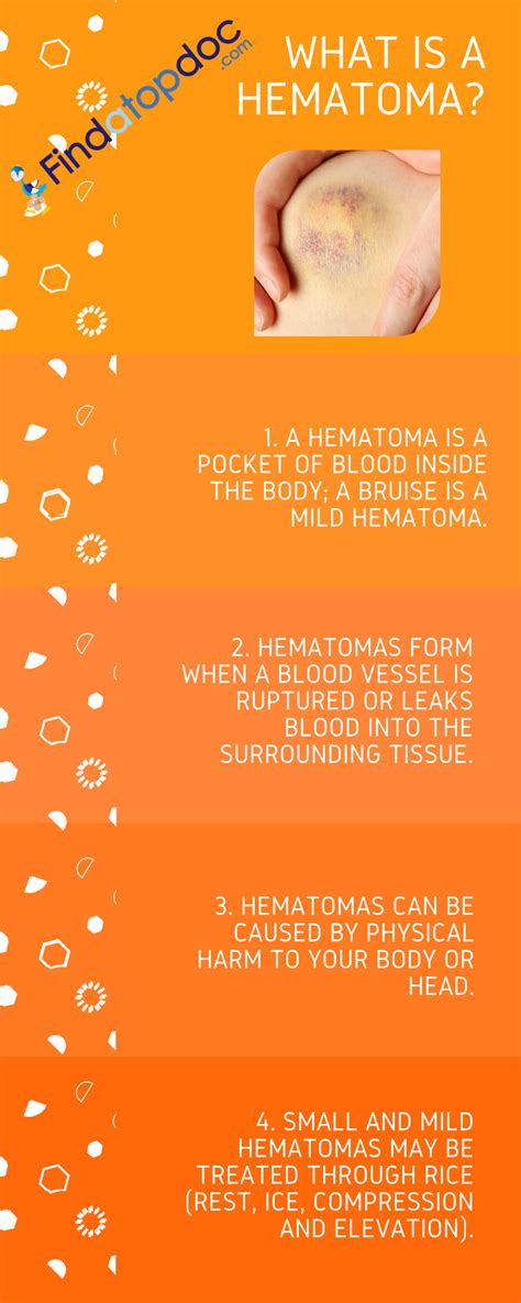 Diagnosis of Hematomas