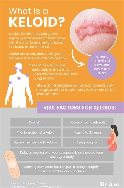 Diagnosis of Keloid Scars