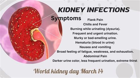 Diagnosis of Kidney Infections Image