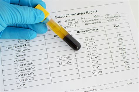 Diagnosis process