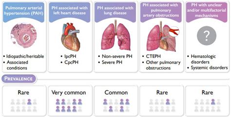 Diagnosis and Treatment