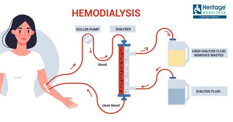 types of dialysis treatment