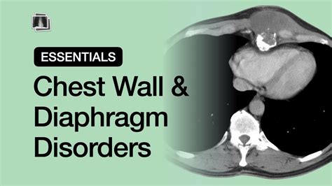 diaphragm disorders