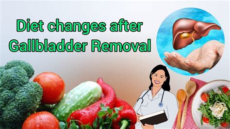 Dietary changes after gallstone surgery