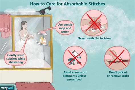 dissolvable stitches