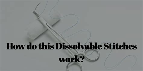 dissolvable stitches work