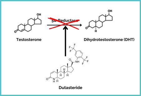 Dutasteride Mechanism of Action