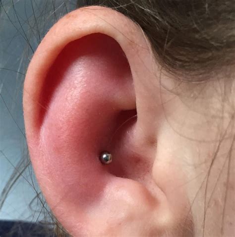 Ear Piercing Swelling Remedies