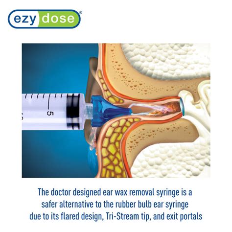 Ear wax removal alternatives