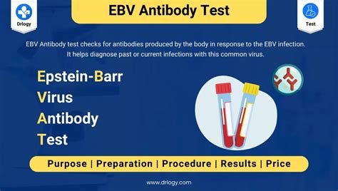ebv antibody test