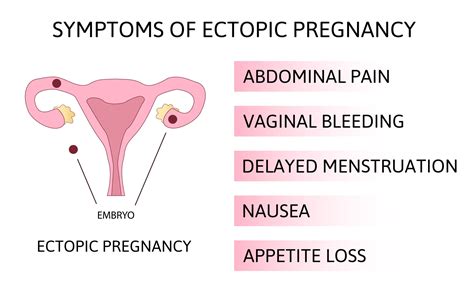 Ectopic Pregnancy and Fertility