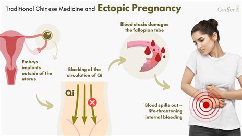 Ectopic Pregnancy Prevention and Awareness