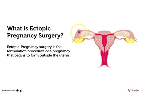 ectopic pregnancy surgery alternatives