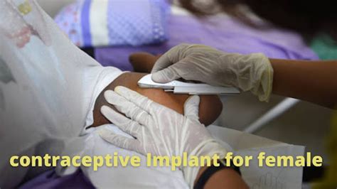 effectiveness of arm birth control implant