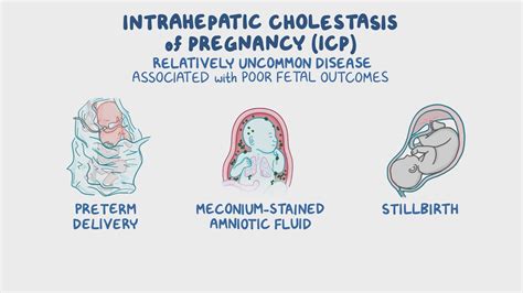 Effects of Cholestasis on Pregnancy