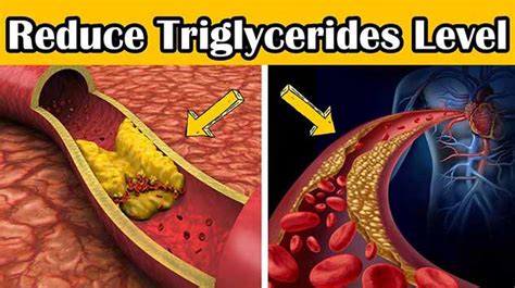 Effects of Triglycerides