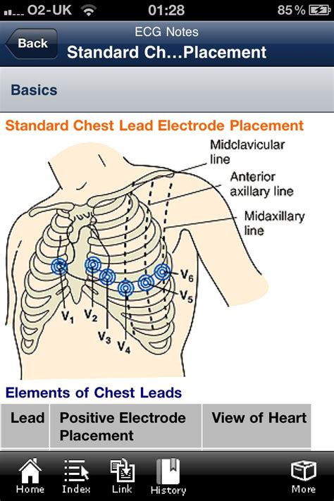 Applications of EKG