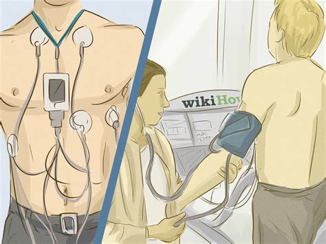 Ekg preparation